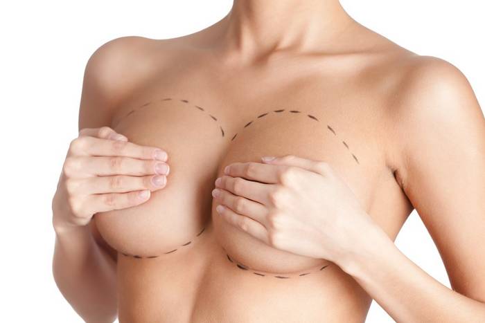 Пластика груди: Что важно знать заранее до операции