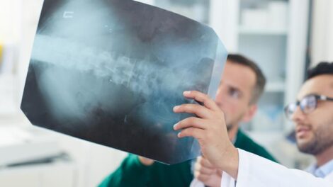 Сучасні рентген апарати: технології, застосування та перспективи