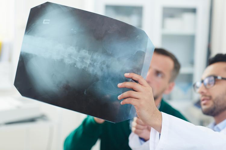 Сучасні рентген апарати: технології, застосування та перспективи