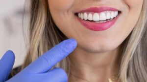 Що потрібно знати про композити та вініри в реставрації зубів