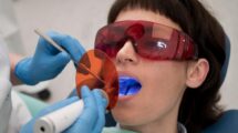 Фотополімерна реставрація зубів: сучасний підхід до естетики усмішки