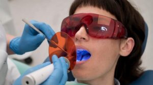 Фотополімерна реставрація зубів: сучасний підхід до естетики усмішки