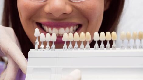 Що потрібно знати перед установкою зубних імплантів: вибір системи, технології та підготовка