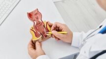 Консультация проктолога для точной диагностики и своевременного лечения